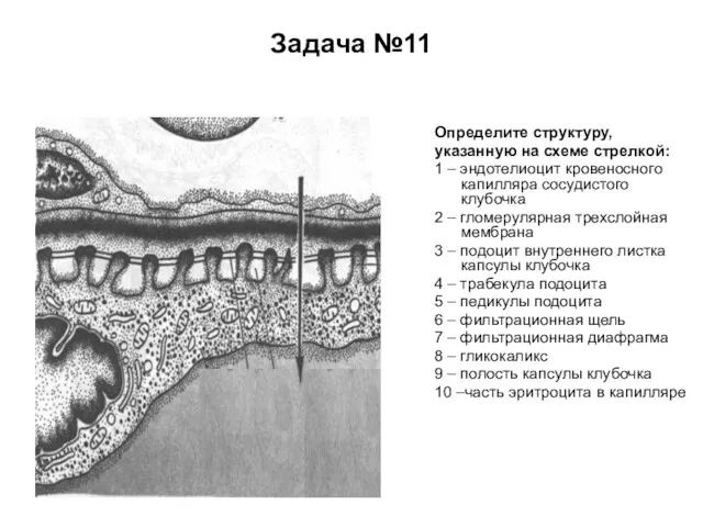 Задача №11 Определите структуру, указанную на схеме стрелкой: 1 – эндотелиоцит кровеносного капилляра