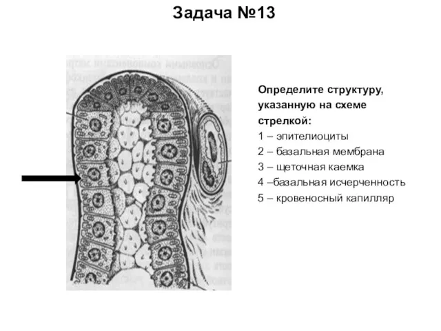 Задача №13 Определите структуру, указанную на схеме стрелкой: 1 – эпителиоциты 2 –