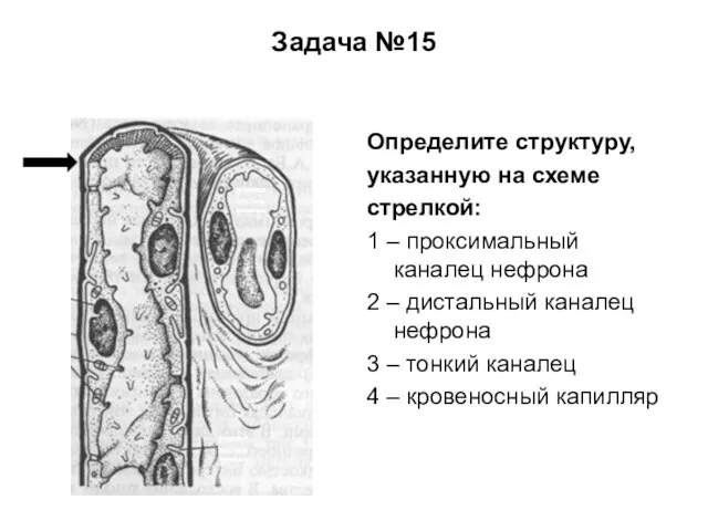 Задача №15 Определите структуру, указанную на схеме стрелкой: 1 – проксимальный каналец нефрона