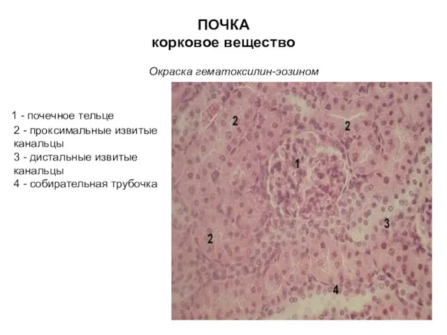 ПОЧКА корковое вещество Окраска гематоксилин-эозином 1 - почечное тельце 2 - проксимальные извитые