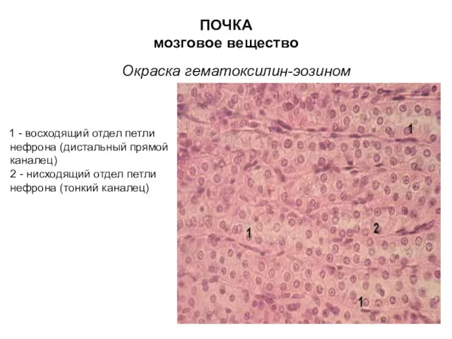 ПОЧКА мозговое вещество Окраска гематоксилин-эозином 1 - восходящий отдел петли нефрона (дистальный прямой