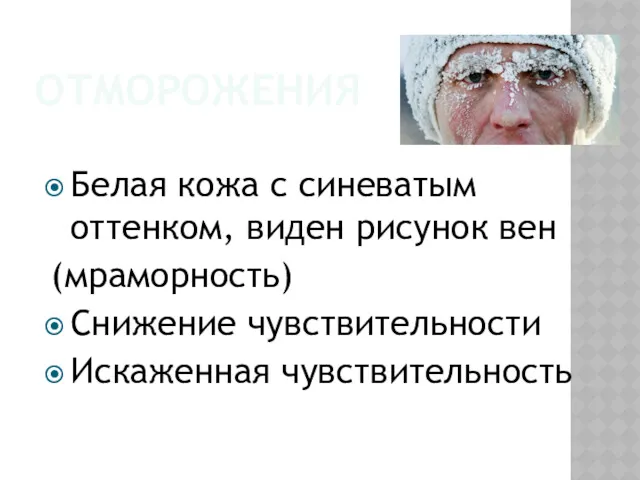 ОТМОРОЖЕНИЯ Белая кожа с синеватым оттенком, виден рисунок вен (мраморность) Снижение чувствительности Искаженная чувствительность