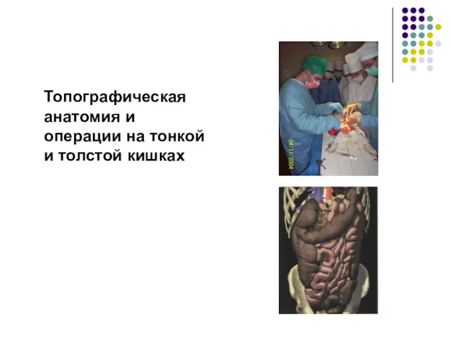 Топографическая анатомия и операции на тонкой и толстой кишках
