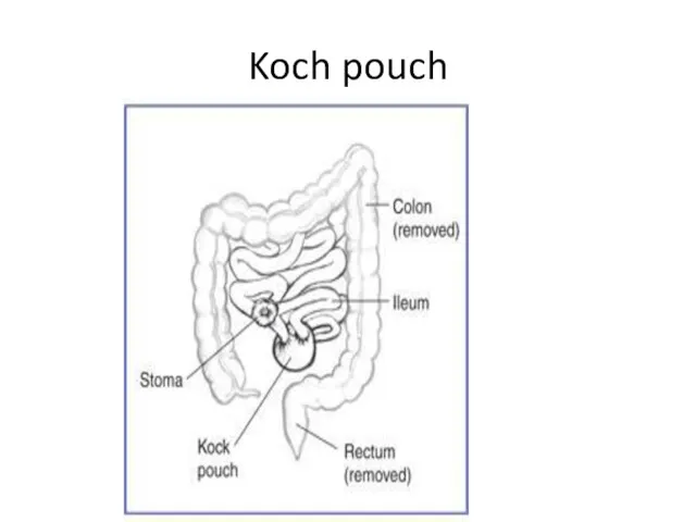 Koch pouch