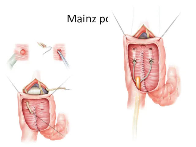 Mainz pouch