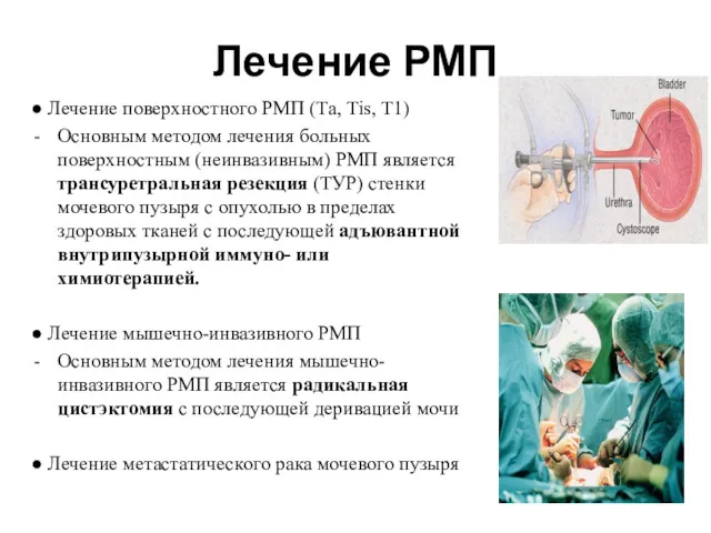 ● Лечение поверхностного РМП (Та, Тis, Т1) Основным методом лечения