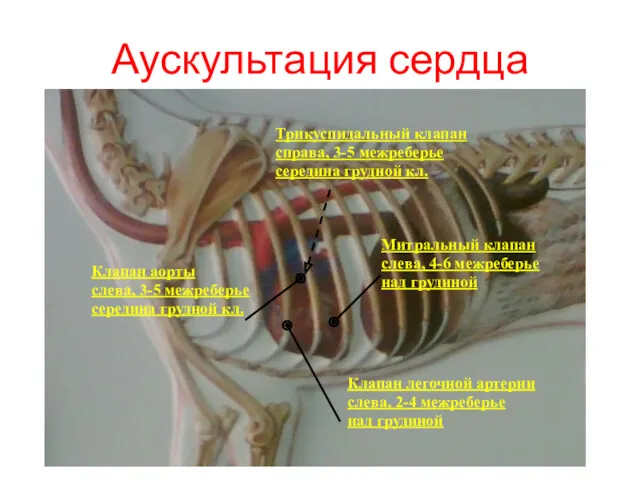 Аускультация сердца Клапан легочной артерии слева, 2-4 межреберье над грудиной