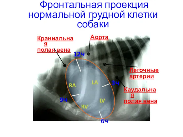 Фронтальная проекция нормальной грудной клетки собаки Аорта Каудальная полая вена