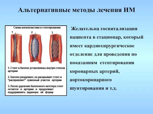 Желательна госпитализация пациента в стационар, который имеет кардиохирургическое отделение для проведения по показаниям