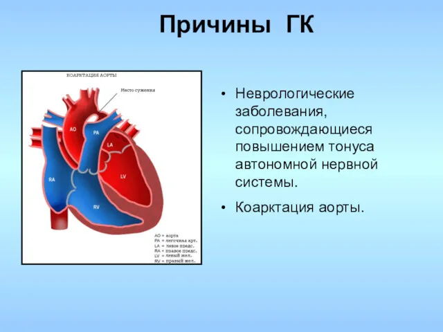 Неврологические заболевания, сопровождающиеся повышением тонуса автономной нервной системы. Коарктация аорты. Причины ГК