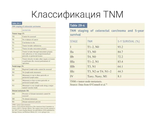 Классификация TNM