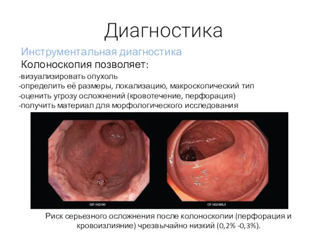 Диагностика Инструментальная диагностика Колоноскопия позволяет: визуализировать опухоль определить её размеры,