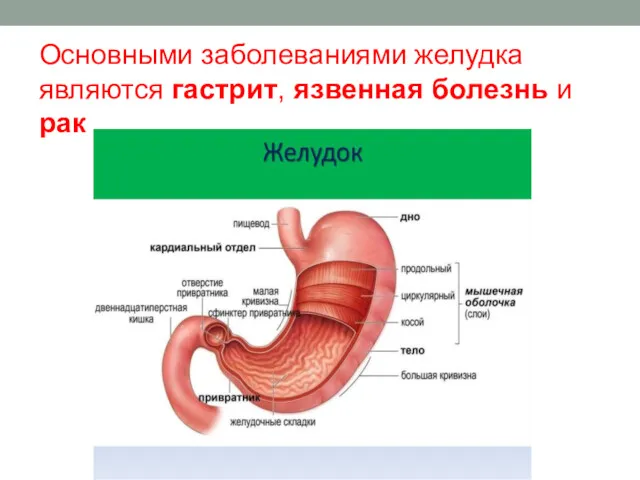 Основными заболеваниями желудка являются гастрит, язвенная болезнь и рак