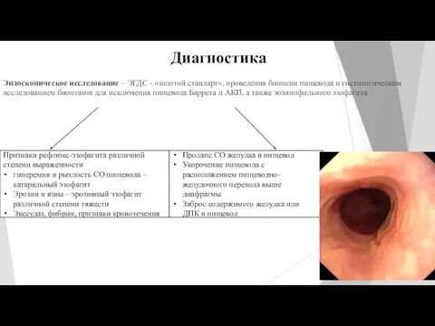 Диагностика Эндоскопическое исследование – ЭГДС - «золотой стандарт», проведения биопсии