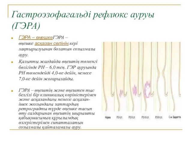 Гастроэзофагальді рефлюкс ауруы (ГЭРА) ГЭРА – өңешкеГЭРА – өңешке асқазан