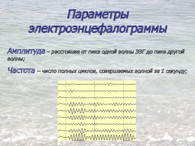 Параметры электроэнцефалограммы Амплитуда – расстояние от пика одной волны ЭЭГ