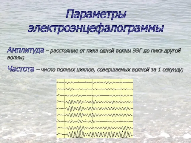 Параметры электроэнцефалограммы Амплитуда – расстояние от пика одной волны ЭЭГ до пика другой