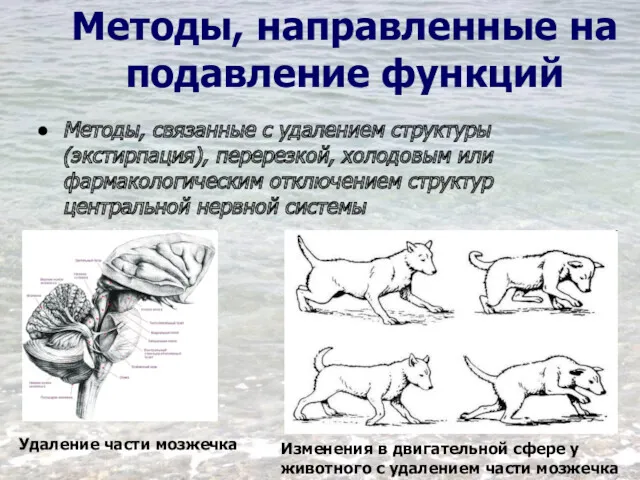 Методы, направленные на подавление функций Методы, связанные с удалением структуры (экстирпация), перерезкой, холодовым