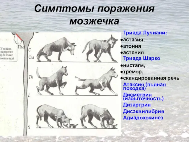 Симптомы поражения мозжечка Триада Лучиани: астазия, атония астения Триада Шарко