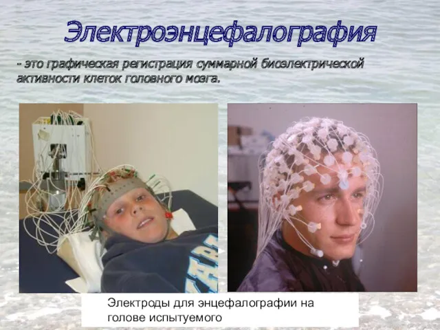 Электроды для энцефалографии на голове испытуемого Электроэнцефалография - это графическая регистрация суммарной биоэлектрической