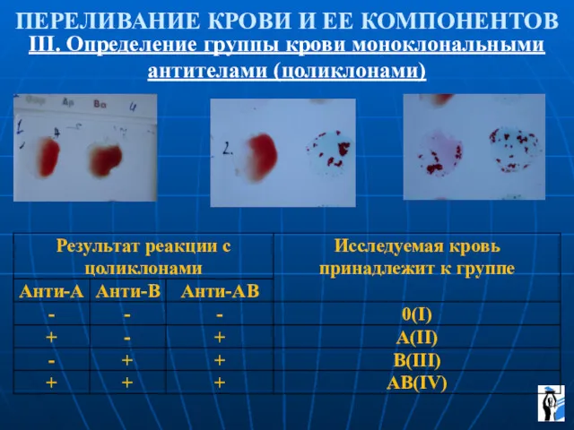 ПЕРЕЛИВАНИЕ КРОВИ И ЕЕ КОМПОНЕНТОВ III. Определение группы крови моноклональными антителами (цоликлонами)