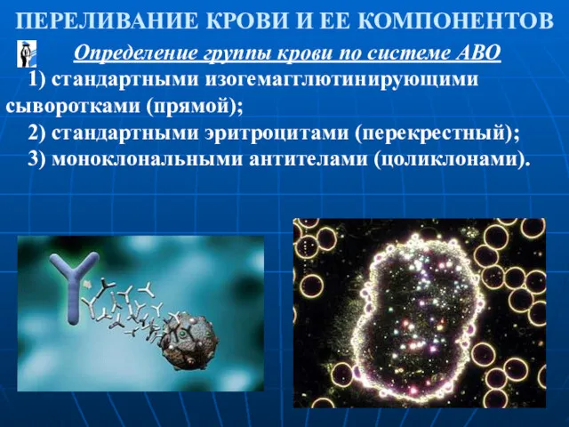 ПЕРЕЛИВАНИЕ КРОВИ И ЕЕ КОМПОНЕНТОВ Определение группы крови по системе