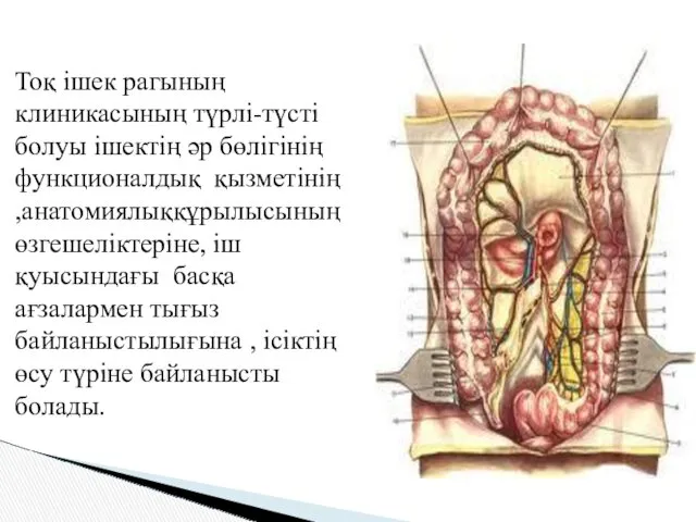 Тоқ ішек рагының клиникасының түрлі-түсті болуы ішектің әр бөлігінің функционалдық