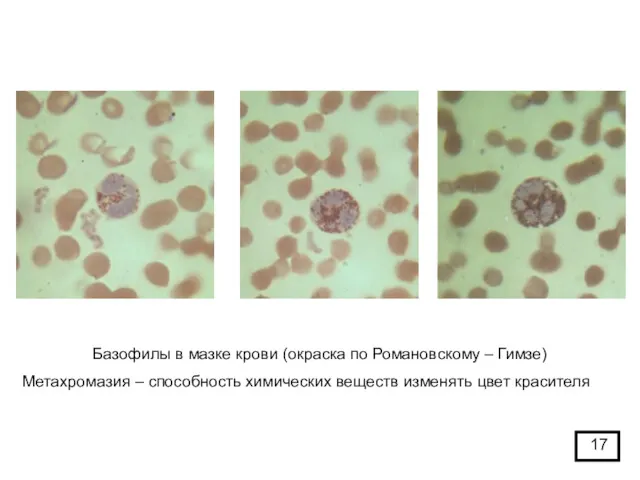 Базофилы в мазке крови (окраска по Романовскому – Гимзе) Метахромазия – способность химических