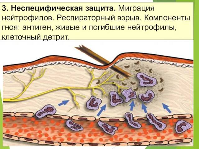 3. Неспецифическая защита. Миграция нейтрофилов. Респираторный взрыв. Компоненты гноя: антиген, живые и погибшие нейтрофилы, клеточный детрит.