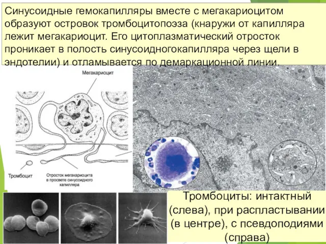 Тромбоциты: интактный (слева), при распластывании (в центре), с псевдоподиями (справа)