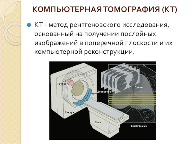 КОМПЬЮТЕРНАЯ ТОМОГРАФИЯ (КТ) КТ - метод рентгеновского исследования, основанный на получении послойных изображений
