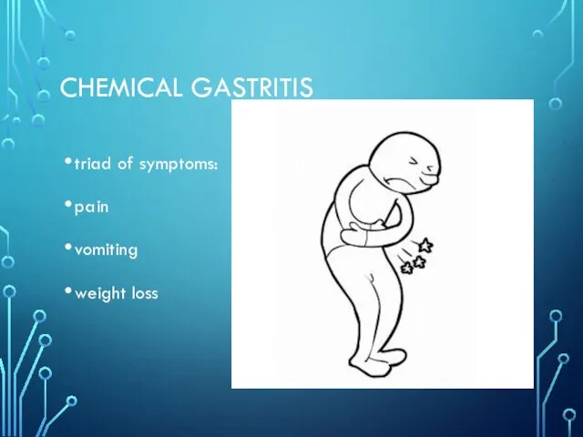 CHEMICAL GASTRITIS triad of symptoms: pain vomiting weight loss