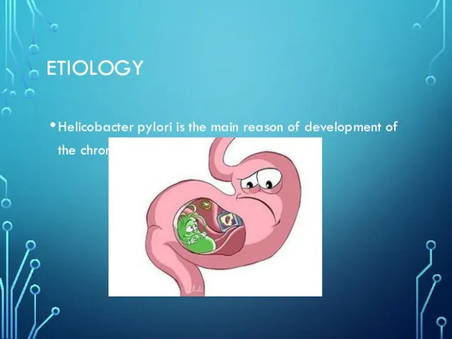 ETIOLOGY Helicobacter pylori is the main reason of development of the chronic gastritis