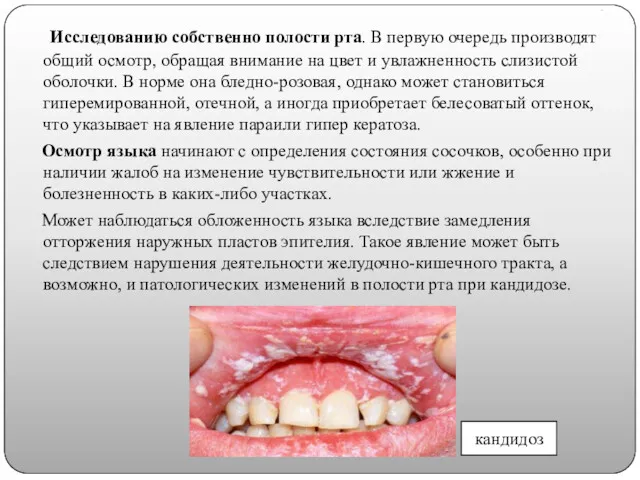 . Исследованию собственно полости рта. В первую очередь производят общий