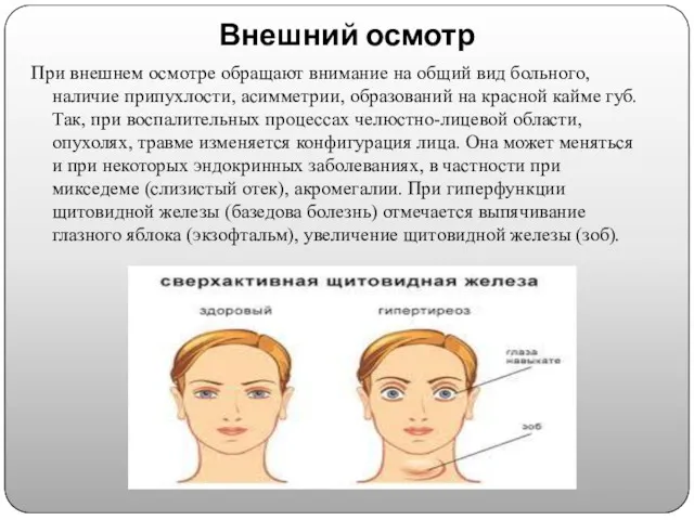 Внешний осмотр При внешнем осмотре обращают внимание на общий вид