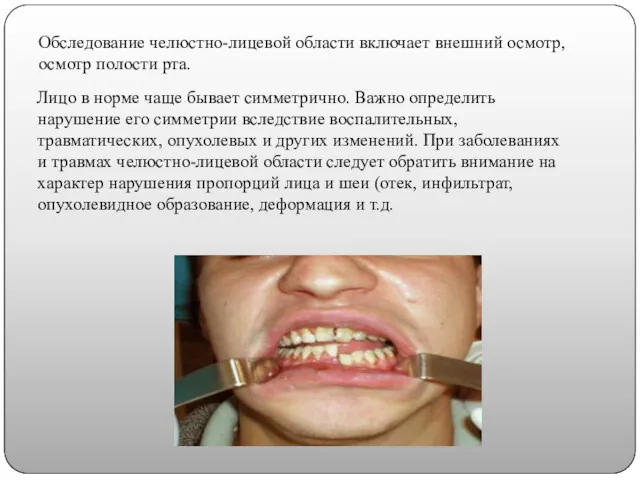 Обследование челюстно-лицевой области включает внешний осмотр, осмотр полости рта. Лицо