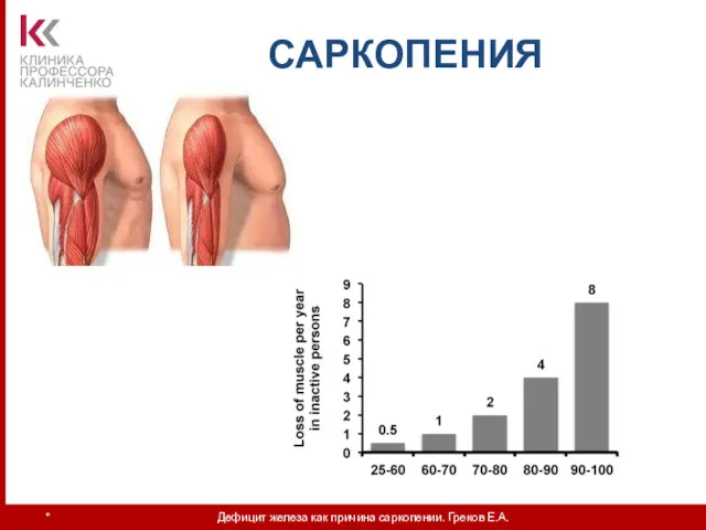 * Дефицит железа как причина саркопении. Греков Е.А. САРКОПЕНИЯ