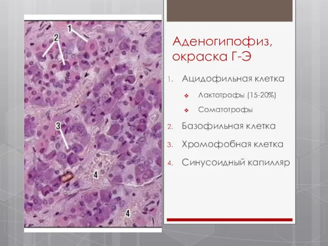 Аденогипофиз, окраска Г-Э Ацидофильная клетка Лактотрофы (15-20%) Соматотрофы Базофильная клетка Хромофобная клетка Синусоидный капилляр