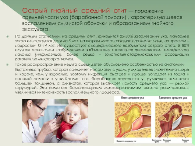 Острый гнойный средний отит — поражение средней части уха (барабанной