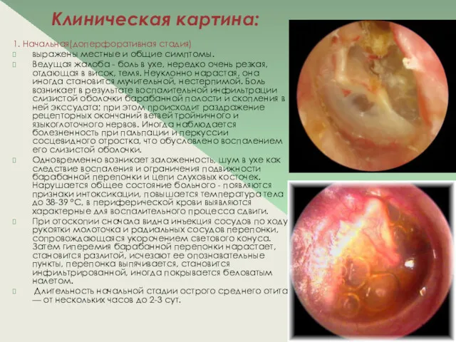 Клиническая картина: 1. Начальная(доперфоративная стадия) выражены местные и общие симптомы.