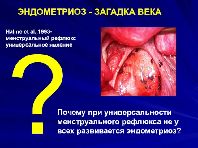 Почему при универсальности менструального рефлюкса не у всех развивается эндометриоз?