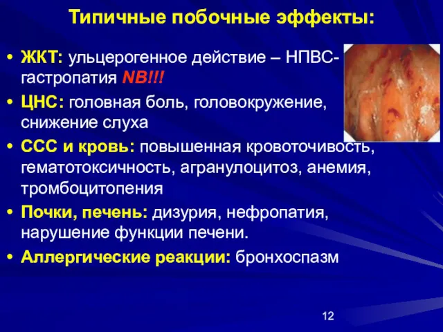 Типичные побочные эффекты: ЖКТ: ульцерогенное действие – НПВС-гастропатия NB!!! ЦНС: