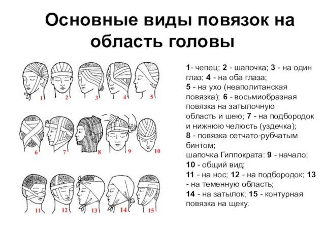 Основные виды повязок на область головы 1- чепец; 2 -