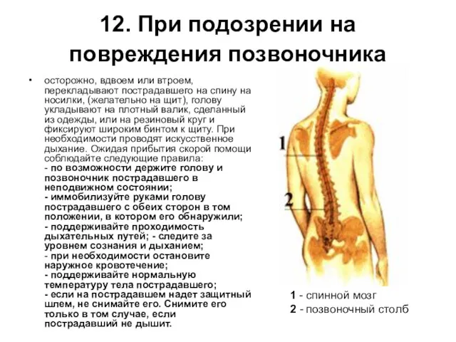 12. При подозрении на повреждения позвоночника осторожно, вдвоем или втроем,