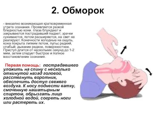 2. Обморок - внезапно возникающая кратковременная утрата сознания. Проявляется резкой