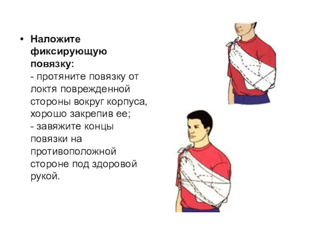 Наложите фиксирующую повязку: - протяните повязку от локтя поврежденной стороны