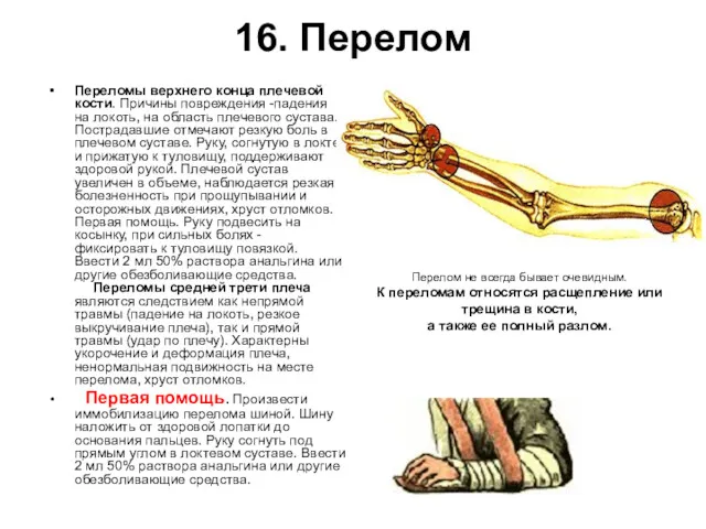 16. Перелом Переломы верхнего конца плечевой кости. Причины повреждения -падения