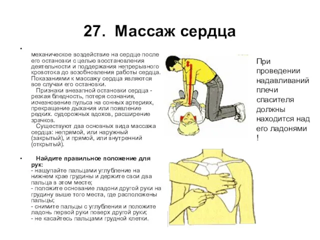 27. Массаж сердца механическое воздействие на сердце после его остановки