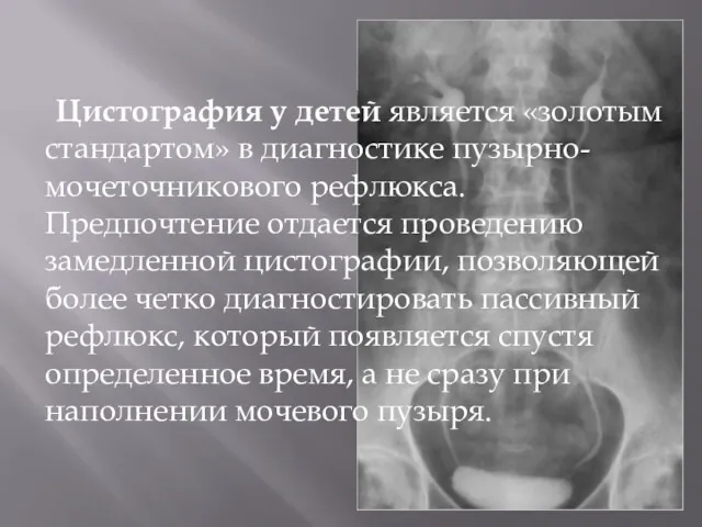 Цистография у детей является «золотым стандартом» в диагностике пузырно-мочеточникового рефлюкса. Предпочтение отдается проведению