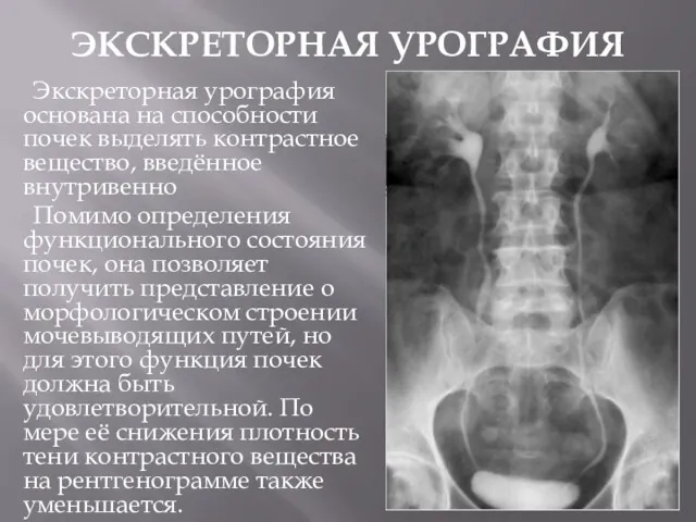 ЭКСКРЕТОРНАЯ УРОГРАФИЯ Экскреторная урография основана на способности почек выделять контрастное вещество, введённое внутривенно